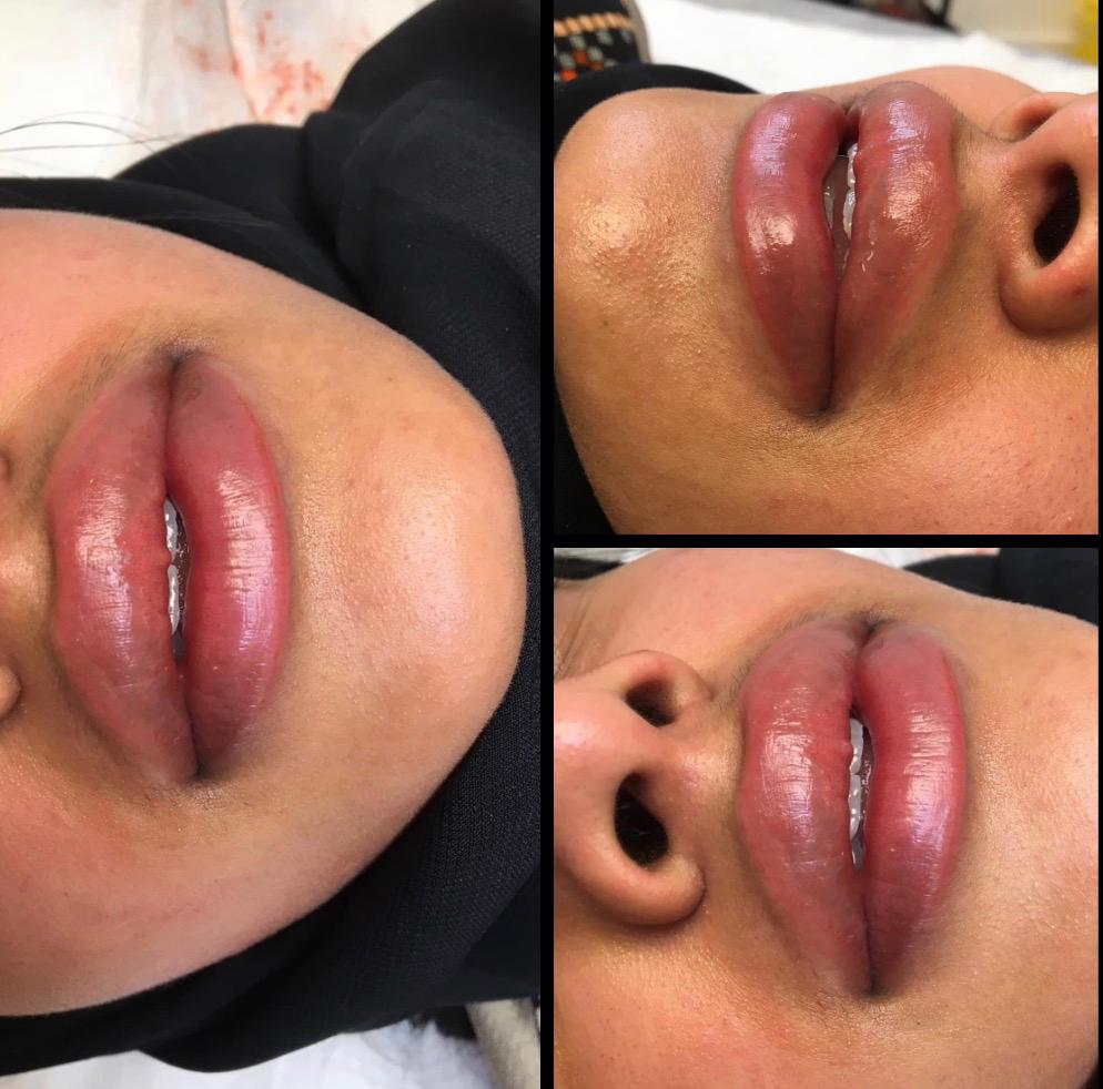 Lips - Semi Permanent Makeup