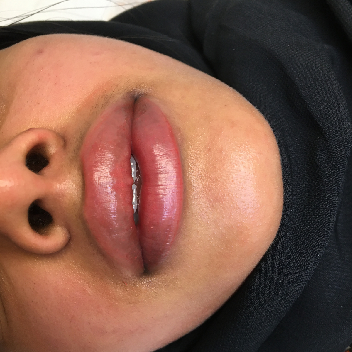 Lips - Semi Permanent Makeup