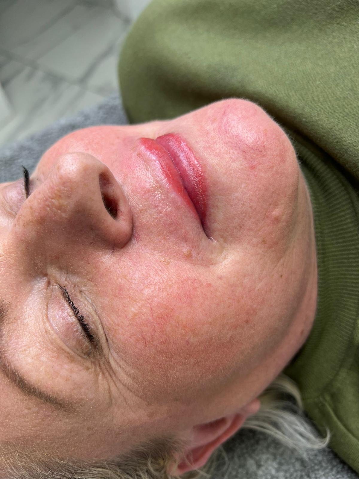 Lips - Semi Permanent Makeup