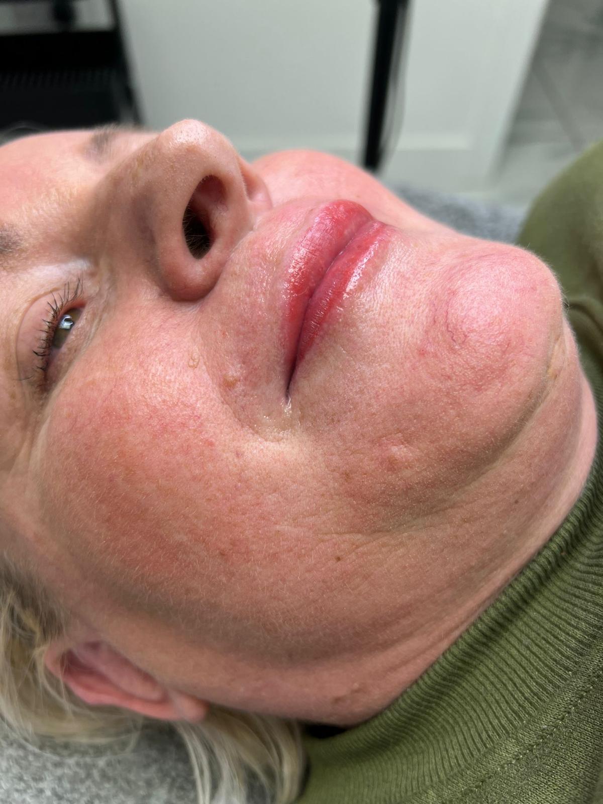 Lips - Semi Permanent Makeup